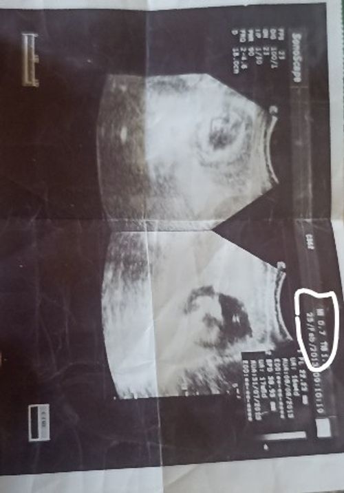 Kara Tahta paylaşım görseli